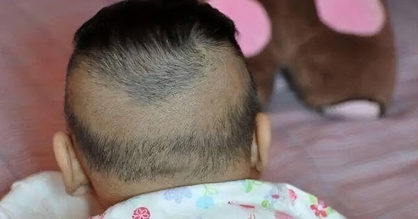 tips perawatan bayi, Perawatan bayi, Lihatlah rambut bayi Anda untuk memprediksi kesehatan anak Anda, Bunda, si Kecil